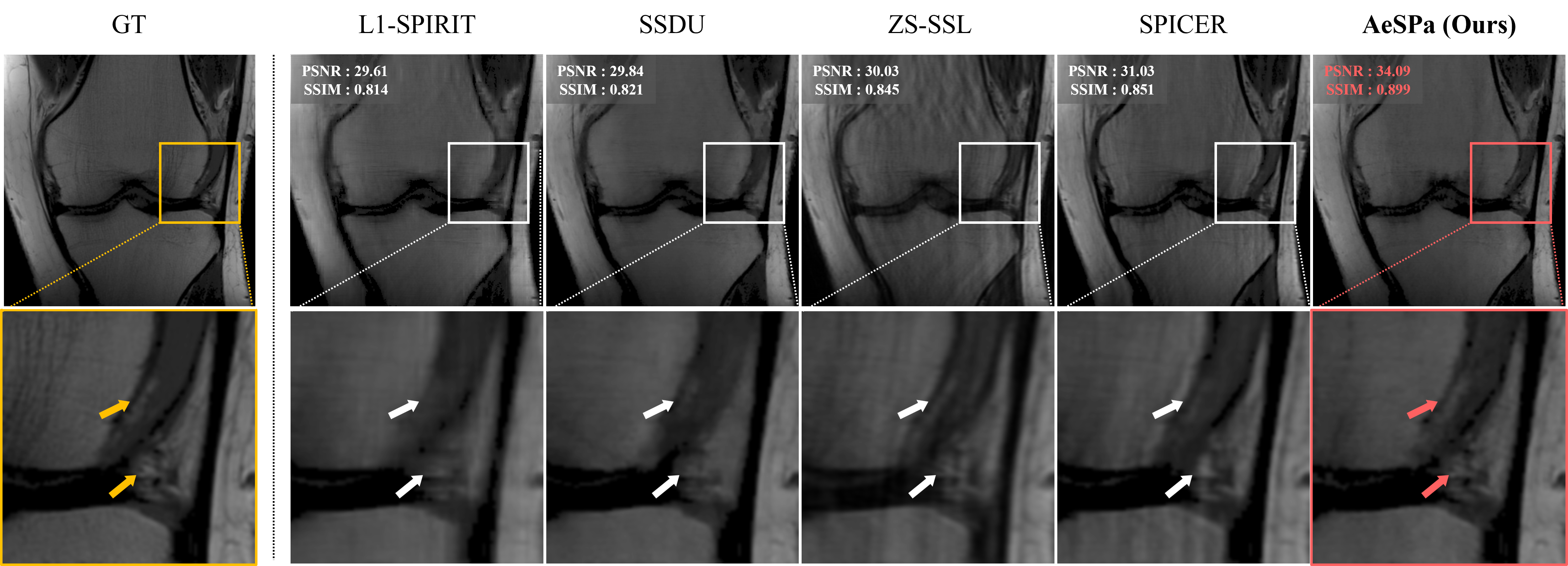 FastMRI Knee Results